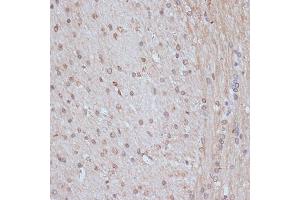 Immunohistochemistry of paraffin-embedded rat brain using SNW1 antibody (ABIN7270386) at dilution of 1:100 (40x lens).
