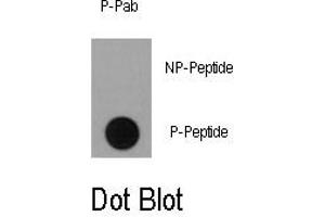 Image no. 1 for anti-Ribosomal Protein S6 Kinase, 90kDa, Polypeptide 1 (RPS6KA1) (pSer363) antibody (ABIN358393) (RPS6KA1 anticorps  (pSer363))
