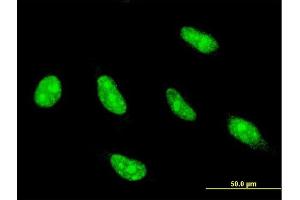 Immunofluorescence of monoclonal antibody to NFYC on HeLa cell.