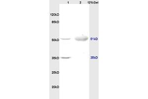 Lane 1: rat brain lysates Lane 2: human colon carcinoma lysates probed with Anti OLFM1/Noelin Polyclonal Antibody, Unconjugated (ABIN678308) at 1:200 in 4 °C.