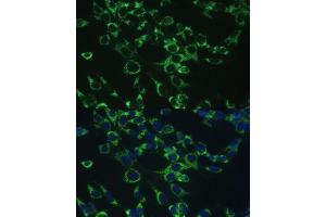 Immunofluorescence analysis of NIH-3T3 cells using COX5B antibody (ABIN3016355, ABIN3016356, ABIN3016357 and ABIN6219733) at dilution of 1:100.