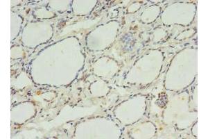 Immunohistochemistry of paraffin-embedded human thyroid tissue using ABIN7175073 at dilution of 1:100 (C11orf68 anticorps  (AA 1-251))