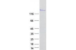 Validation with Western Blot