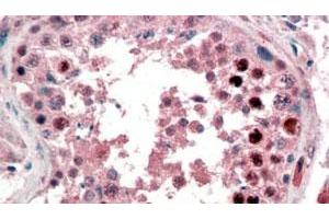 NANOG polyclonal antibody  (2 ug/mL) staining of paraffin embedded human testis. (Nanog anticorps  (C-Term))