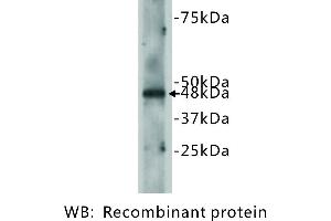 Image no. 2 for anti-Cadherin EGF LAG Seven Pass G-Type Receptor 2 (CELSR2) antibody (ABIN1112870) (CELSR2 anticorps)