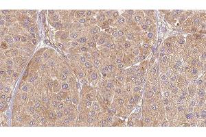 ABIN6277133 at 1/100 staining Human Melanoma tissue by IHC-P. (ELSPBP1 anticorps  (C-Term))