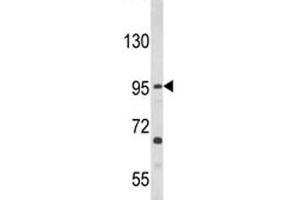 Western blot analysis of TLR3 antibody and HL-60 lysate.