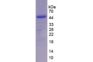 SDS-PAGE analysis of Chicken Interleukin 17 Protein. (IL-17 Protéine)