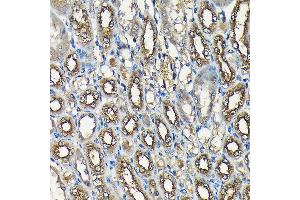 Immunohistochemistry of paraffin-embedded mouse kidney using USP5 Rabbit pAb (ABIN1683231, ABIN3018687, ABIN3018688 and ABIN6220542) at dilution of 1:100 (40x lens).