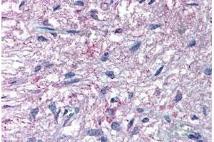 Immunohistochemical (Formalin/PFA-fixed paraffin-embedded sections) staining in human pituitary with GPR50 polyclonal antibody . (GPR50 anticorps  (C-Term))