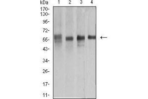 Western blot analysis using KRT10 mouse mAb against A431 (1), COS7 (2), Jurkat (3), and HEK293 (4) cell lysate. (Keratin 10 anticorps  (AA 345-454))