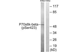 Western Blotting (WB) image for anti-Ribosomal Protein S6 Kinase, 70kDa, Polypeptide 2 (RPS6KB2) (pSer423) antibody (ABIN1847634) (RPS6KB2 anticorps  (pSer423))