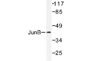Image no. 1 for anti-Jun B Proto-Oncogene (JUNB) antibody (ABIN265489) (JunB anticorps)