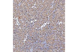 IHC analysis of TRMT61A using anti-TRMT61A antibody (ABIN7599220). (TRMT61A anticorps  (AA 1-289))