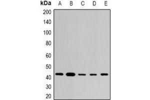 Western blot analysis of STX expression in THP1 (A), SKOV3 (B), mouse brain (C), mouse lung (D), rat heart (E) whole cell lysates. (ST8SIA2 anticorps)
