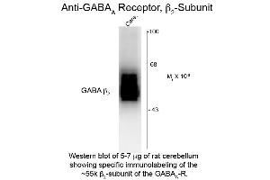 Western Blot of Anti-GABA(A) Receptor beta 2 (Rabbit) Antibody - 612-401-D50 Western Blot of Rabbit anti-GABA(A) Receptor beta 2 antibody.