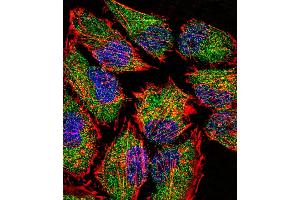 Fluorescent confocal image of Hela cell stained with LSD1 Antibody (N-term) (ABIN388021 and ABIN2845463).
