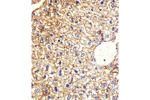 Immunohistochemical analysis of paraffin-embedded M.