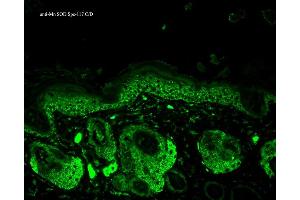 Immunohistochemistry analysis using Rabbit Anti-SOD2 Polyclonal Antibody .