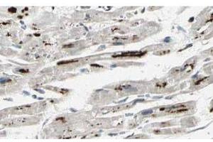 Affinity Purified anti-iASPP antibody shows strong cytoplasmic and membranous staining of myocytes in human heart tissue. (PPP1R13L anticorps  (Isoform 1))