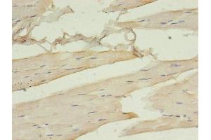 Immunohistochemistry of paraffin-embedded human skeletal muscle tissue using ABIN7161378 at dilution of 1:100 (Doublecortin anticorps  (AA 108-360))