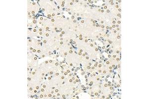 Immunohistochemistry of paraffin embedded rat kidney using SUV39H1 (ABIN7075770) at dilution of 1:500 (400x lens) (SUV39H1 anticorps)