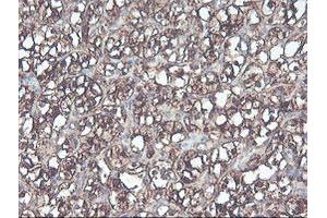 Image no. 9 for anti-CNDP Dipeptidase 2 (Metallopeptidase M20 Family) (CNDP2) antibody (ABIN1497548) (CNDP2 anticorps)