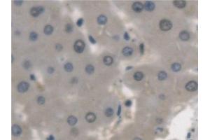 Detection of ARSA in Human Liver Tissue using Polyclonal Antibody to Arylsulfatase A (ARSA) (Arylsulfatase A anticorps)