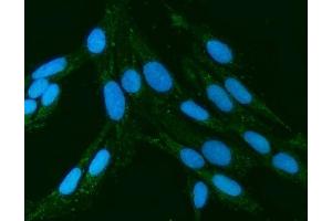 IF analysis of Kindlin 2/FERMT2 using anti-Kindlin 2/FERMT2 antibody (ABIN7599515). (FERMT2 anticorps  (AA 1-650))