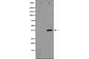 Western blot analysis of I kappaB alpha phosphorylation expression in COS7 whole cell lysates,The lane on the left is treated with the antigen-specific peptide.