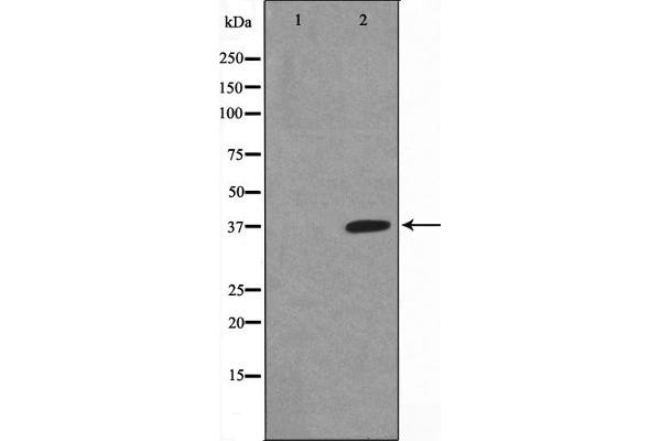 NFKBIA anticorps  (pSer32, pSer36)
