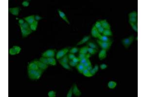 Immunofluorescence staining of PC-3 cells with ABIN7168748 at 1:166, counter-stained with DAPI. (PTTG2 anticorps  (AA 1-202))