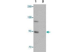 Western blot analysis of mouse brain tissue with ZC3H12B polyclonal antibody  at 1 ug/mL in (Lane 1) the absence and (Lane 2) the presence of blocking peptide . (ZC3H12B anticorps  (N-Term))