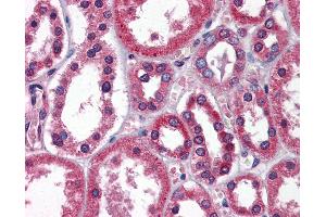Anti-TBC1D1 antibody IHC of human kidney.