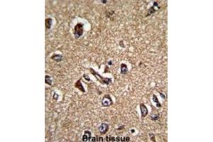 Immunohistochemistry (IHC) image for anti-Serine/threonine Kinase Receptor Associated Protein (STRAP) antibody (ABIN3001728)