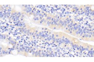 #VALUE! (Urocortin 2 anticorps  (AA 20-112))