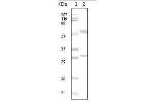 Western Blotting (WB) image for anti-Estrogen Receptor 1 (ESR1) antibody (ABIN1107144) (Estrogen Receptor alpha anticorps)