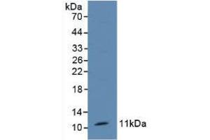 Western blot analysis of Mouse Kidney Tissue. (TFF1 anticorps  (AA 1-87))