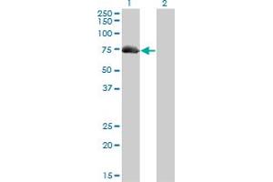 Western Blot analysis of AKAP10 expression in transfected 293T cell line by AKAP10 monoclonal antibody (M04), clone 8C10.