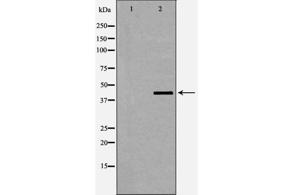 Dematin anticorps  (pSer403)