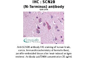 Image no. 1 for anti-Sodium Channel, Voltage-Gated, Type II, beta (SCN2B) antibody (ABIN1739059) (SCN2B anticorps)