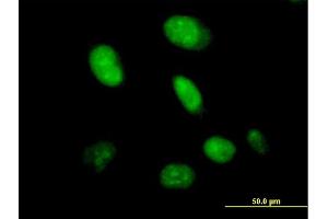 Immunofluorescence of purified MaxPab antibody to CXorf43 on HeLa cell. (HDX anticorps  (AA 1-690))