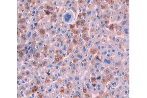 Used in DAB staining on fromalin fixed paraffin- embedded liver tissue (Sonic Hedgehog anticorps  (AA 28-193))