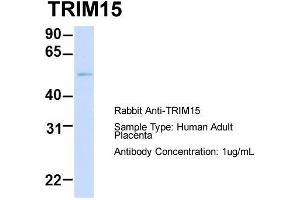 Host: Rabbit  Target Name: TRIM15  Sample Tissue: Human Adult Placenta  Antibody Dilution: 1. (TRIM15 anticorps  (Middle Region))