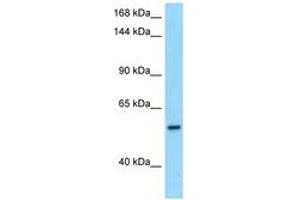 PDE6B 抗体  (AA 105-154)