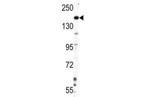Western blot analysis of Nestin antibody and HepG2 lysate
