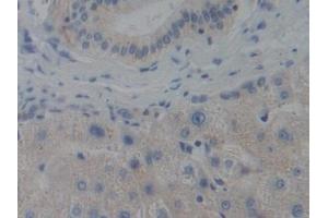 Detection of CENPH in Human Liver Tissue using Polyclonal Antibody to Centromere Protein H (CENPH) (CENPH anticorps  (AA 1-247))