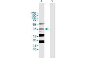Western Blot analysis of STRADA expression in transfected 293T cell line by STRADA MaxPab polyclonal antibody. (STRADA anticorps  (AA 1-348))