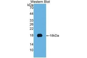 Detection of Recombinant KRT19, Human using Monoclonal Antibody to Cytokeratin 19 (CK19) (Cytokeratin 19 anticorps  (AA 245-391))