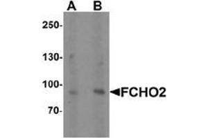 Western blot analysis of FCHO2 in rat heart tissue lysate with FCHO2 Antibody  at (A) 1 and (B) 2 µg/ml (FCHO2 anticorps  (Middle Region))
